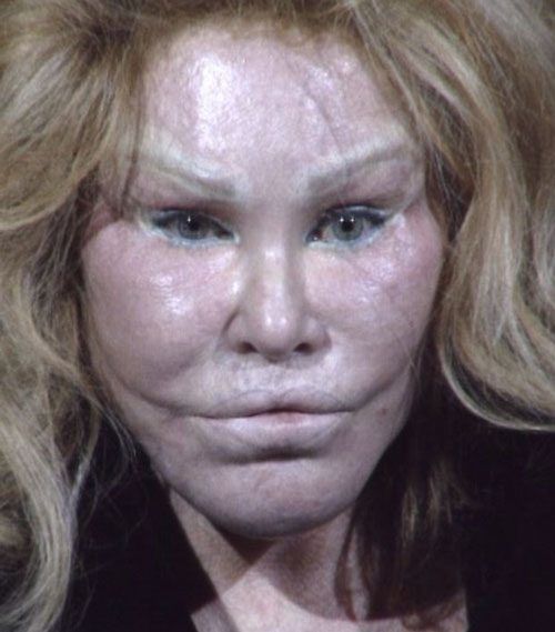 Dlisted  I Guess It Was Jocelyn Wildenstein’s Man’s Turn To Get Arrested For Being A Violent Mess